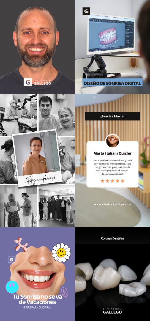 Clínica Dental Gallego | Marketing Digital · RRSS (1)