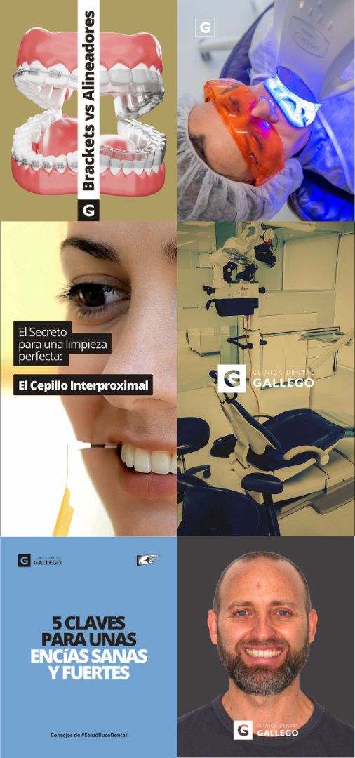Clínica Dental Gallego | Marketing Digital · RRSS (2)