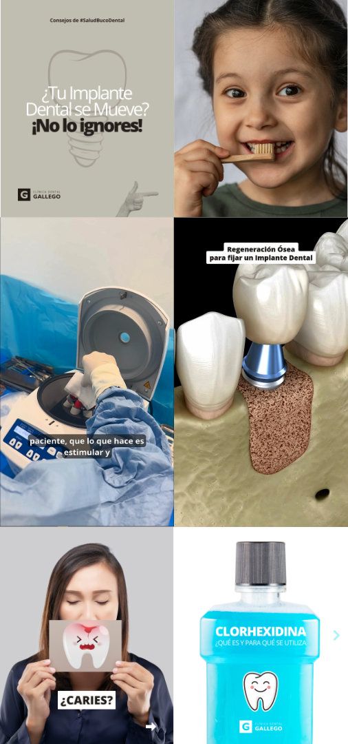 Clínica Dental Gallego | Marketing Digital · RRSS (3)
