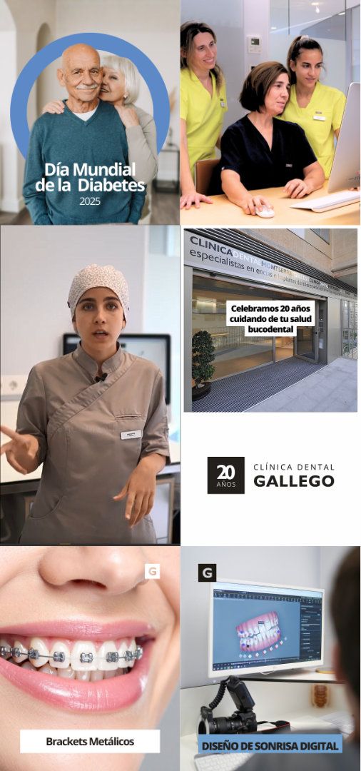 Clínica Dental Gallego | Marketing Digital · RRSS (4)