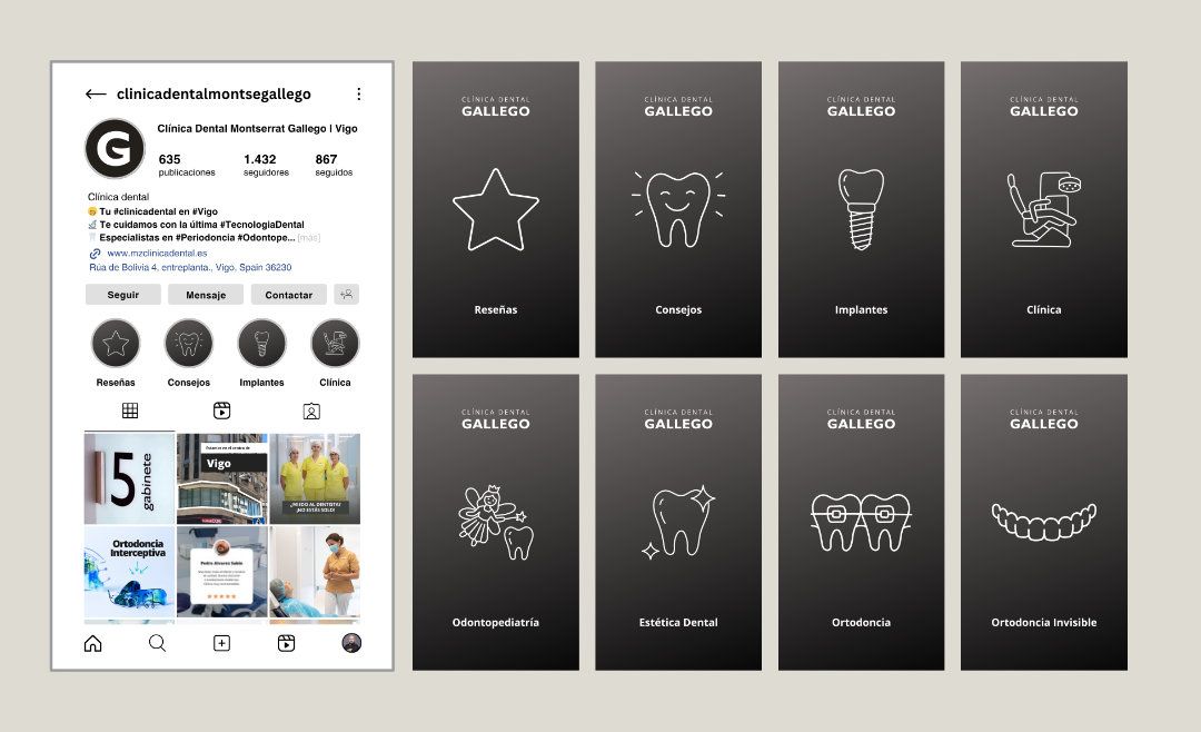 Clínica Dental Gallego | ReBranding · Instagram